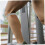 12pcs Elastic Patella Ring Meniscus Tear Support Thin Jumper Brace 5