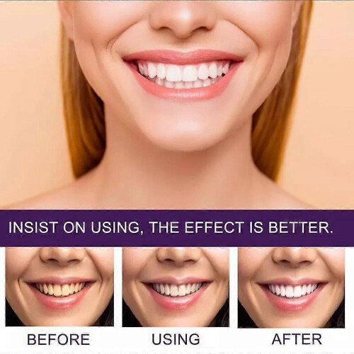 (3pcs) 7 Pro Strong Whitening Toothpaste, Intense Whitening Toothpaste 7 Pro 2
