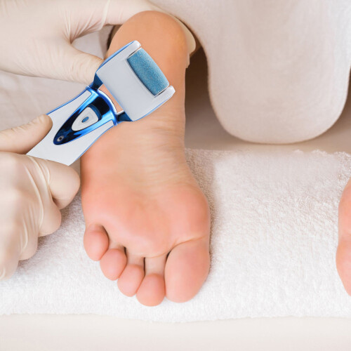 1Set Voetverzorging Elektrische Pedicure File En Effectief 2