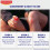 Elastoplast Elastoplast Spray Plaster for Wounds (40ml), Quick-Drying and Easy to Apply on E 7