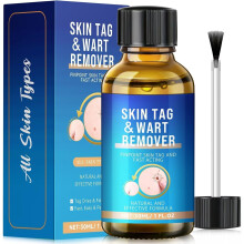 Wart Remover,Fast-Acting Skin Tag & Wart Remover for Feet & Hands,Skin Tag Remov