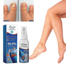 (2pcs) Fungus Foot Spray, Care Grade Foot Spray, Foot Fungus