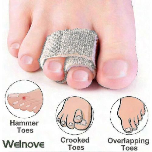 6-pack Hammer Toe Straighteners for Correcting Hammer, Broken, Crooked Overlapping Toes Hk 2