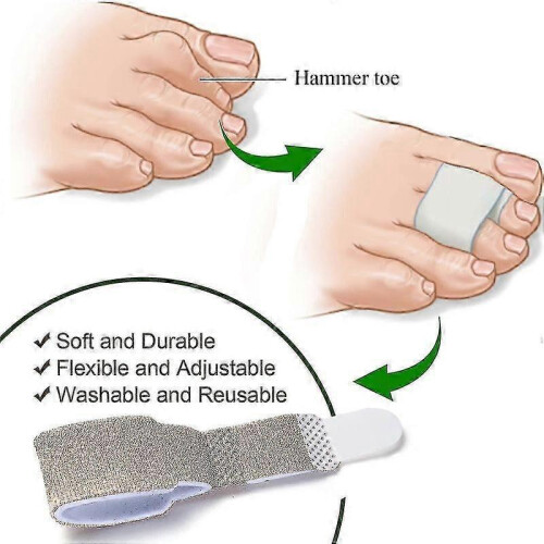 Straightening hammer toes with 6-pack correctors 1