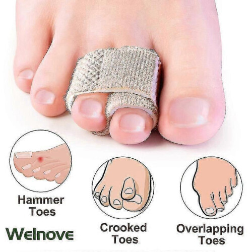 Straightening hammer toes with 6-pack correctors 2