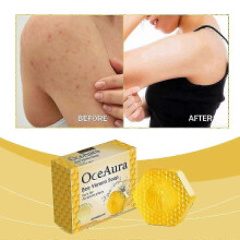 Keratosis Pilaris Bee Venom Soap, Keratosis Pilaris Soap, Keratosis Pilaris Bar Soap, Bee Venom Soap Treatment for Keratosis Pilaris