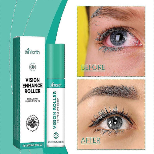 Vision Enhance Roller, Ophthalmic Vision Enhance Roller, Vision Enhance Roller 1