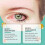 Vision Enhance Roller, Ophthalmic Vision Enhance Roller, Vision Enhance Roller 3