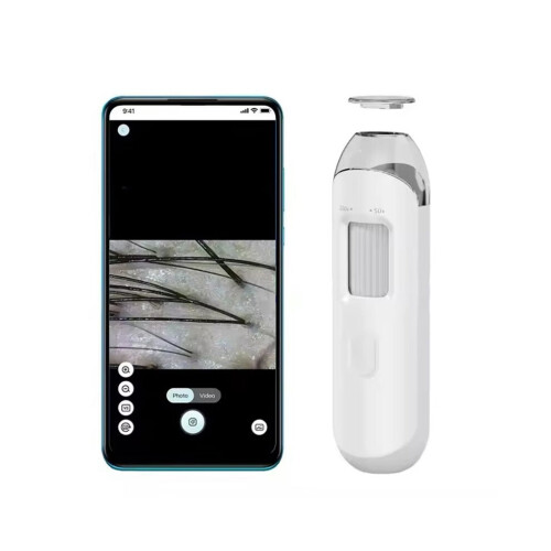 Electron dermatoscope, scalp camera detection, professional facial skin analyzer, digital microscope, 1