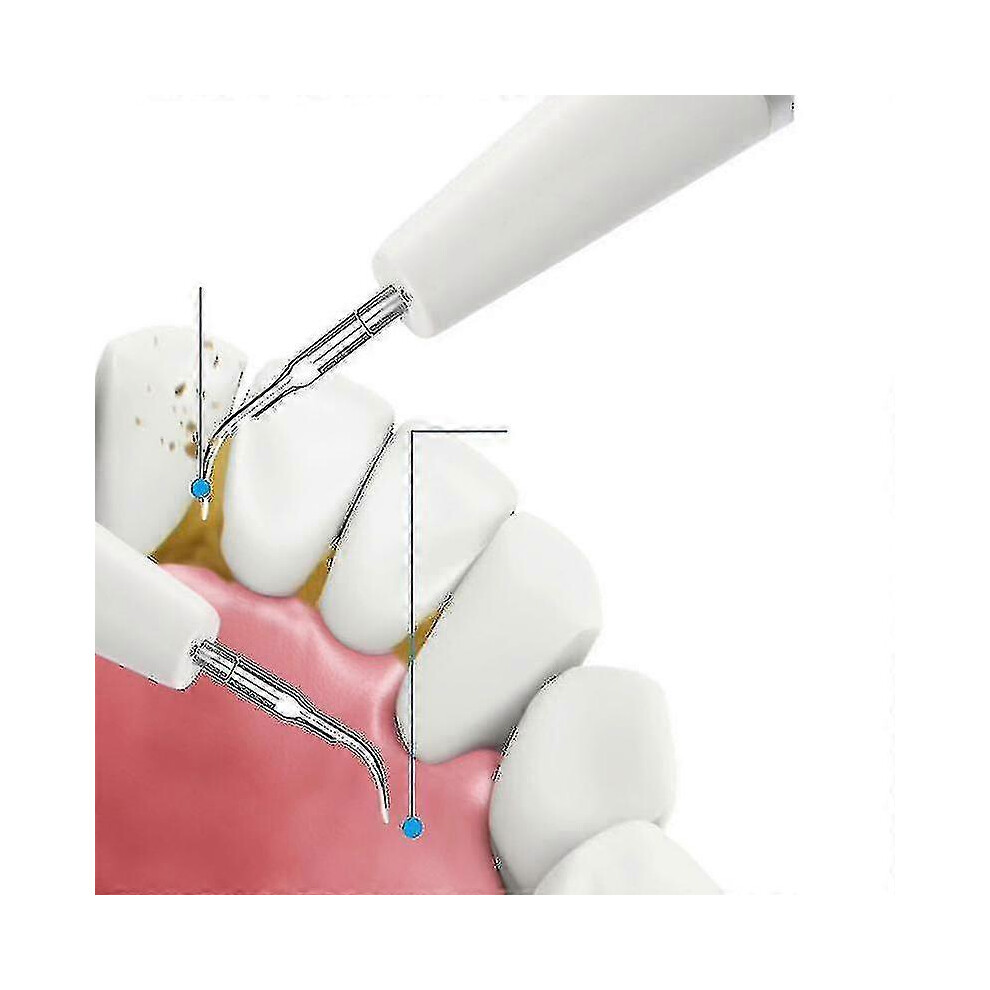 Ultrasonic Electric Calculus Remover Tartar Scaler Scraper Tooth Cleaner