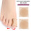 (S) Correcteur Hallux Valgus Unisexe 2