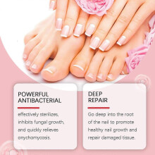 (1pc) Extra strength toenail fungus treatment for damaged and discoloured nails xyxkk