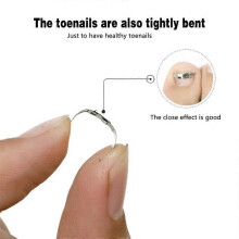 (S) Ingrown Toe Nail Correction Tool Toenail Straightening Correctors Patch Tool Straightening Clip Brace Pedicure Tool