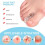 10 Pack Toe Spacers Separators, Bunion Corrector Gel Orthotics for Bunion, Overlapping Toes,Hallux Valgus 7