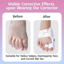 Kids Bunion Corrector Adjustable Silicone Toe Straightener Splint for Toe Alignment and Foot Support