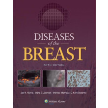 Diseases of the Breast 5e by Jay R. Harris Hardcover Book