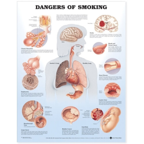 Dangers of Smoking Anatomical Chart Paperback Book
