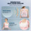 Pink Posture Back Brace til mænd og kvinder – Åndbar 8