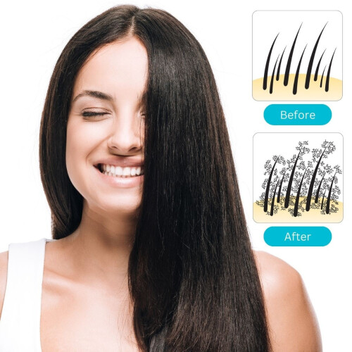 Hair Pro - Auburn / Rood