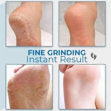 (With 10x Frosted Head) Electric Callus Remover, Callus Removal, Foot Rechargeable, Pedicure Set