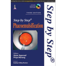Step by Step Phacoemulsification Paperback Book