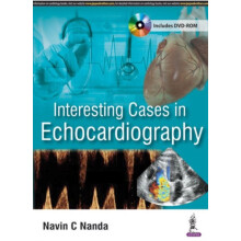 Interesting Cases in Echocardiography by Navin C Nanda Paperback Book