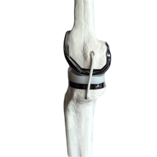 2X Knee Joint Model Simulation Replacement Surgery Meniscus Ligament Cartilages Surgery Model,Artificial Knee Joint 2