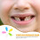 100St Baby Tooth Storage Box Design Assorti Kleuren 5