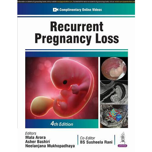 Recurrent Pregnancy Loss by Mala Arora Paperback Book