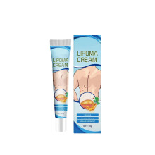 Lipoma Removal Cream Treatments Lump Remove Skin Swelling Pain Relief Cream 20g