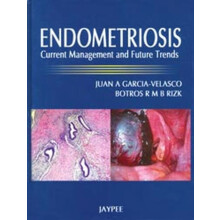 Endometriosis Current Management and Future Trends by Juan A GarciaVel