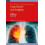 Lung Cancer and Imaging Hardcover Book 1