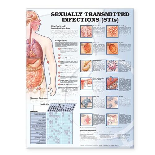 Sexually Transmitted Infections Anatomical Chart Paperback Book