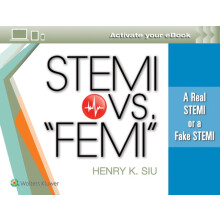 STEMI vs. FEMI A Real STEMI or a Fake STEMI by Henry K Siu Paperback B