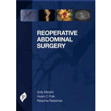 Reoperative Abdominal Surgery by Solly Mizrahi Hardcover Book