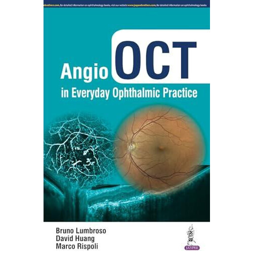 Angio OCT in Everyday Ophthalmic Practice by Bruno Lumbroso Paperback