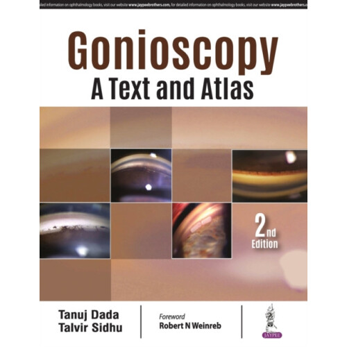 Gonioscopy A Text and Atlas by Tanuj Dada Paperback Book