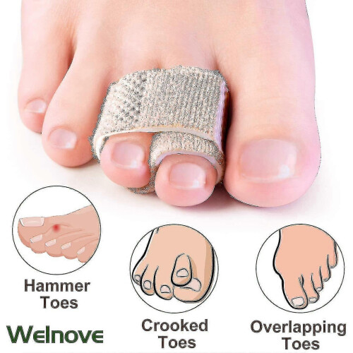 Hammer Toe Straighteners, 6-Pack for Toe Alignment and Protection with Soft Fabric Wrap 2