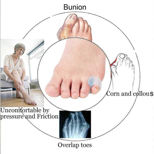 Silicone Toe Separators and Protectors for 2nd 3rd 4th Pinky Toes 10 Pack 1