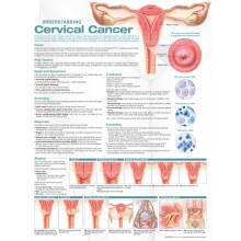 Understanding Cervical Cancer Anatomical Chart Paperback Book