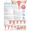 Understanding Cervical Cancer Anatomical Chart Paperback Book 1