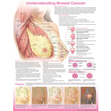 Understanding Breast Cancer Anatomical Chart Paperback Book
