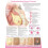 Understanding Breast Cancer Anatomical Chart Paperback Book 1