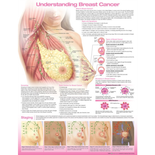 Understanding Breast Cancer Anatomical Chart Paperback Book