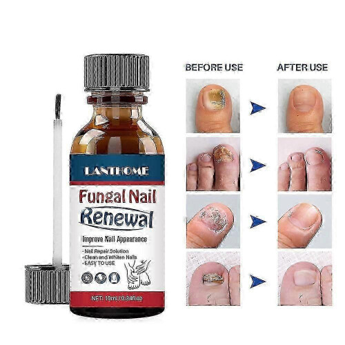 Lanthome Nail Repair Liquid Gentle Care 10Ml 2