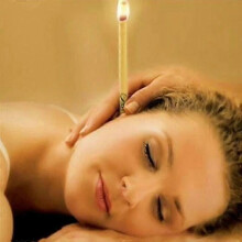 suitable for 20 Pcs Ear Candle Coning Beewax Natural Ear Treatment Ear Wax Removar
