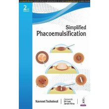 Simplified Phacoemulsification by Navneet Toshniwal Paperback Book