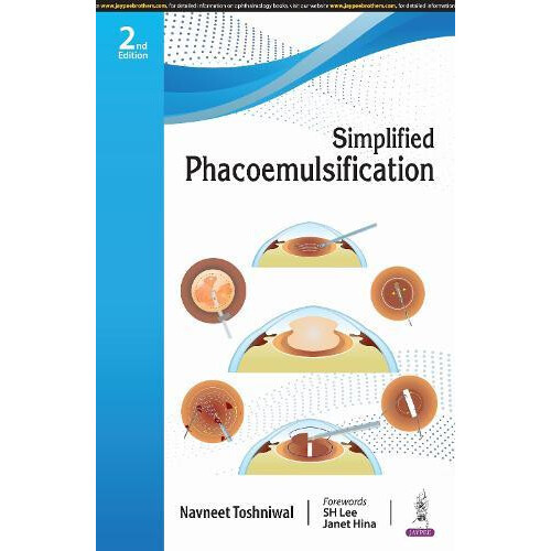 Simplified Phacoemulsification by Navneet Toshniwal Paperback Book
