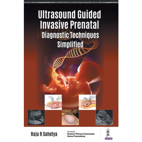 Ultrasound Guided Invasive Prenatal Diagnostic Techniques Simplified b