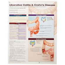 Ulcerative Colitis Crohns Disease Paperback Book